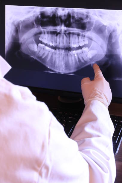 Best Emergency Dental Extractions in Monroe, NC
